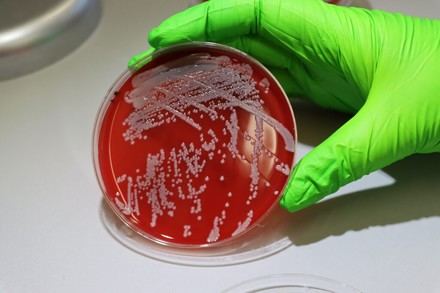 ¿Eres uno de ellos? El 30% de la población es portadora de esta peligrosa bacteria sin saberlo